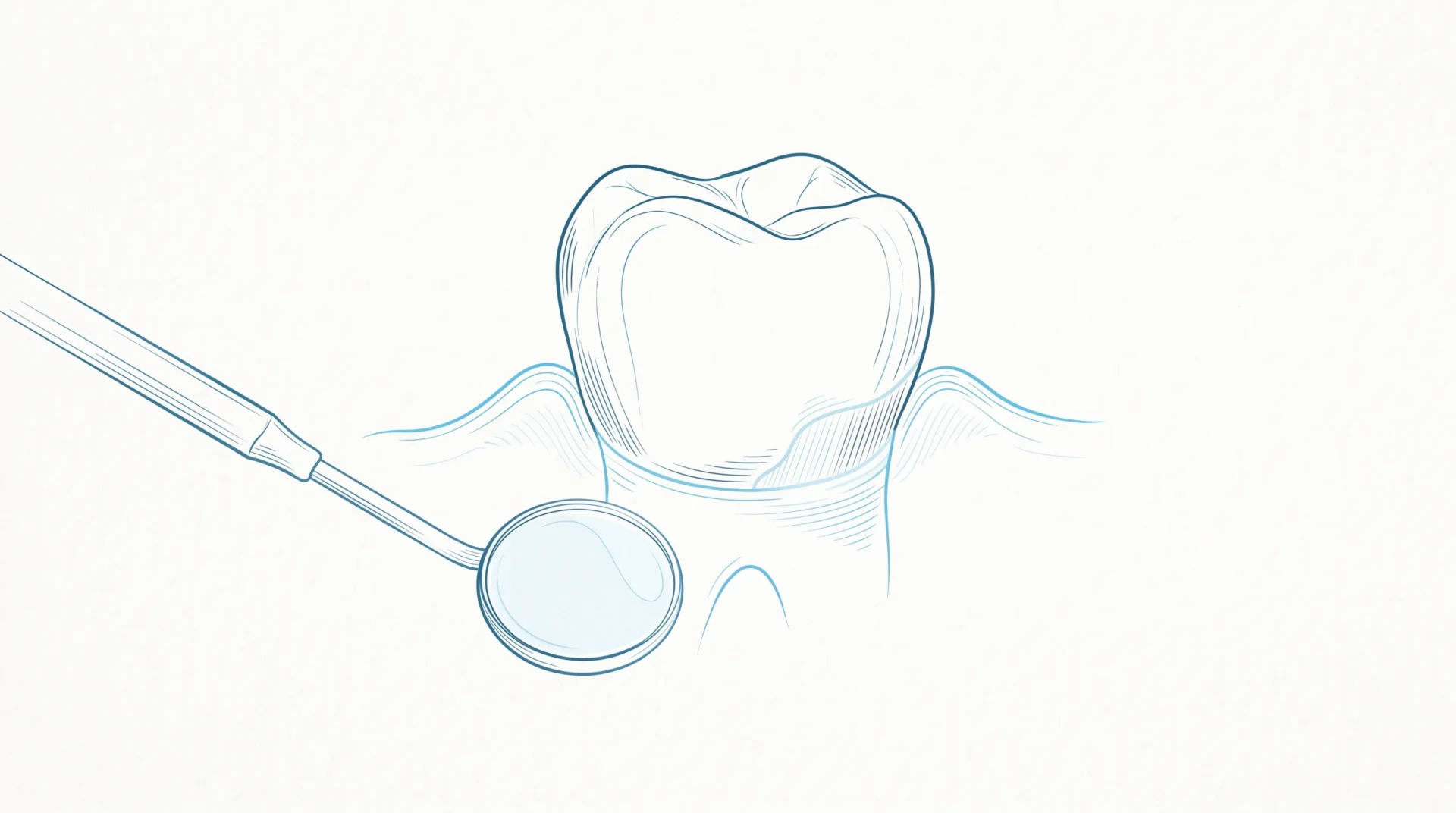 A close-up molar shows gumline wear and exposed dentine linked to sensitive teeth.